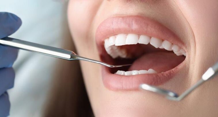 Удивительные факты о вредных продуктах для зубов