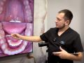 Обточка зуба: как проходит процедура и стоит ли её бояться?